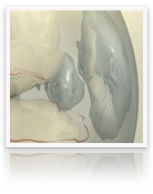 collage_image